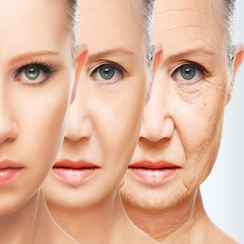 Виды и типы старения кожи лица.