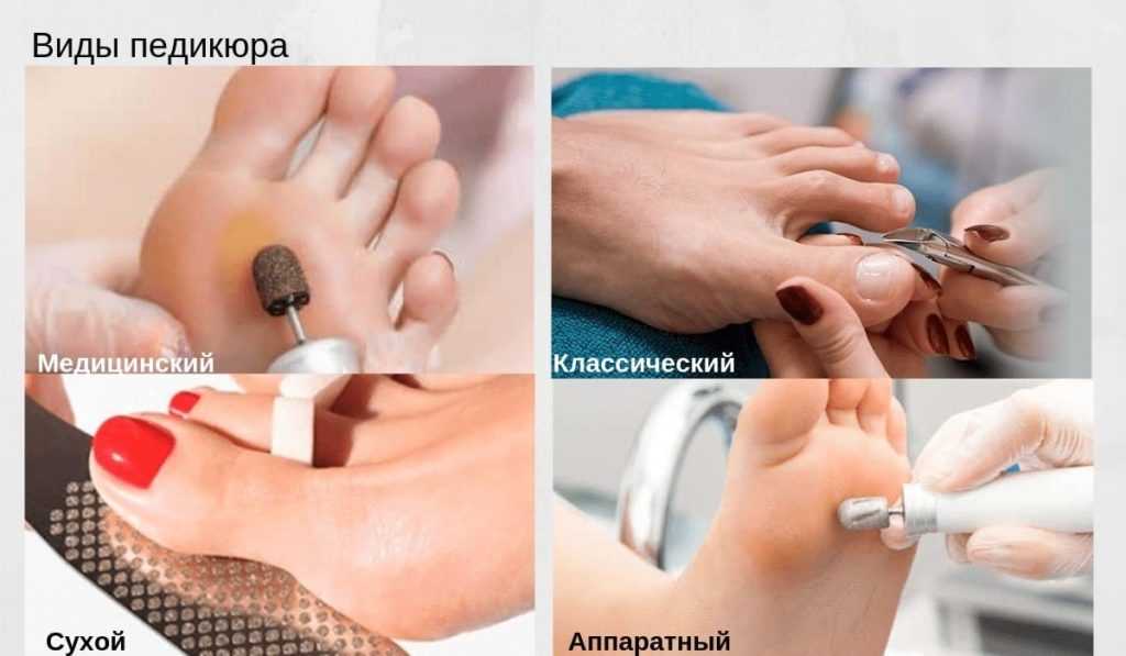 Технология выполнения аппаратного педикюра.