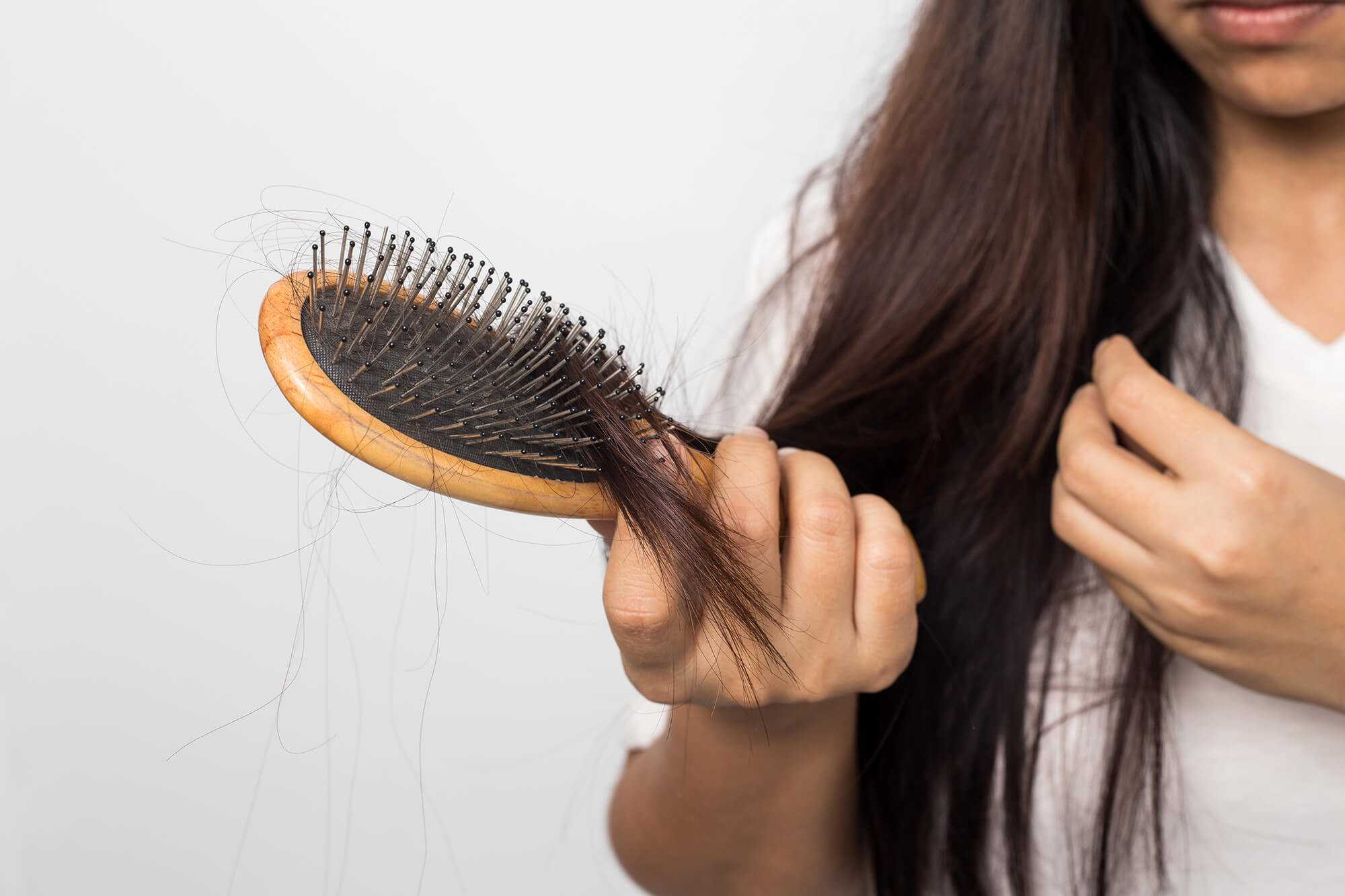 Как избежать выпадения волос: что такое алопеция, почему выпадают волосы