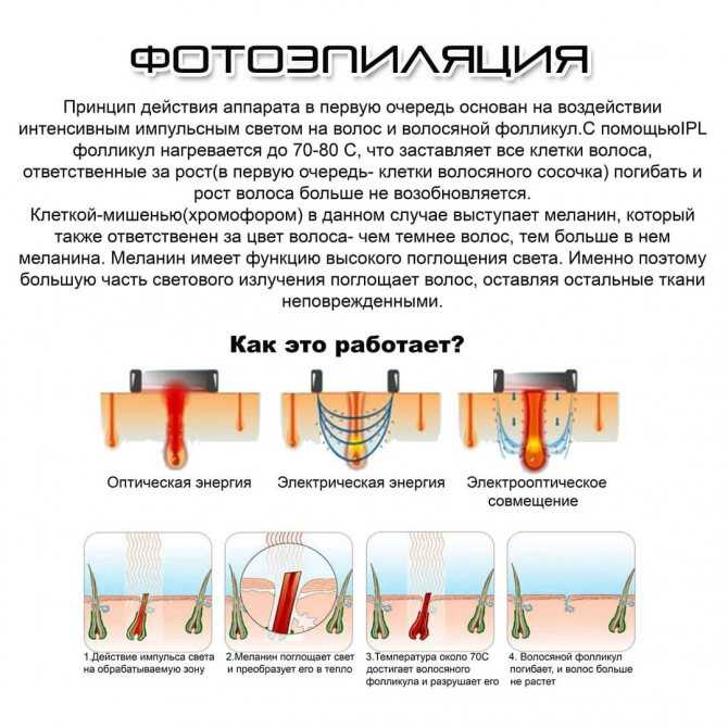 Особенности лазерной эпиляции. фото «до» и «после» лазерной эпиляции. | krasota.ru