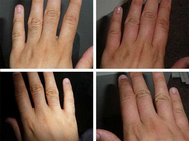 Эпиляция рук: удалить или осветлить волосы на руках