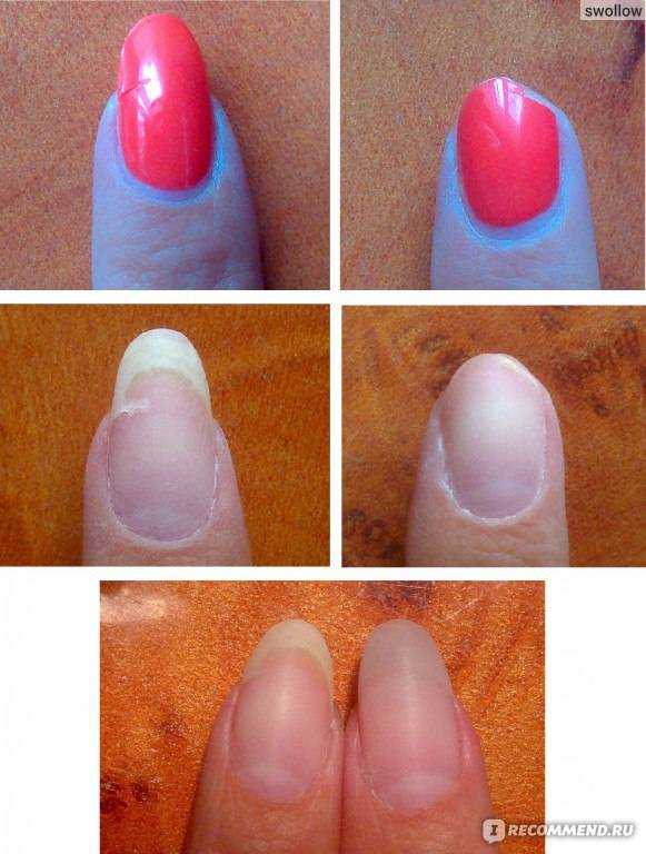Как ухаживать за ногтями
