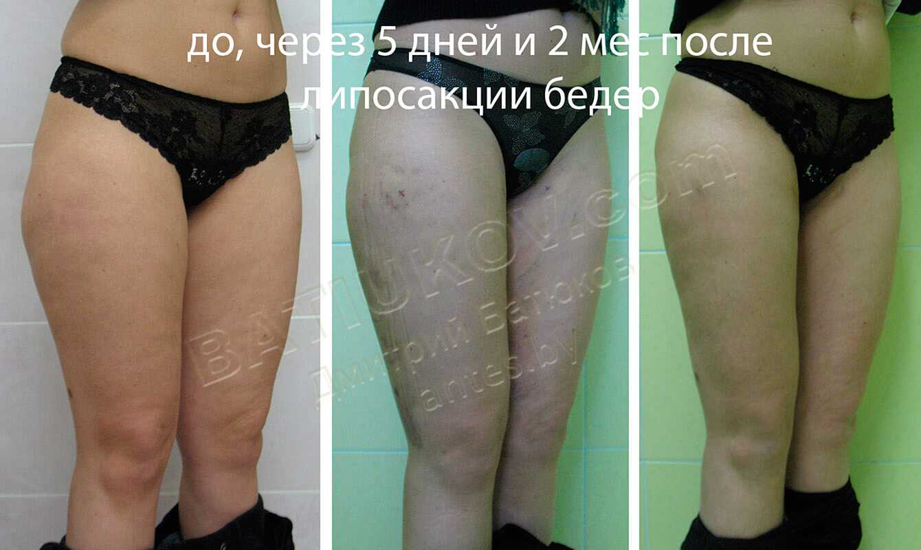 «удалишь слишком мало — опухоль вырастет снова, слишком много — пациент может остаться инвалидом» | медицинская россия